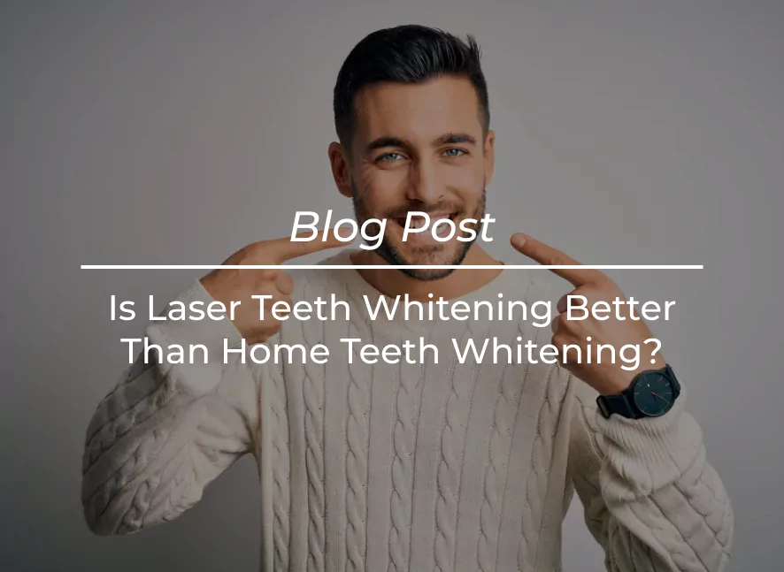 Laser Teeth Whitening