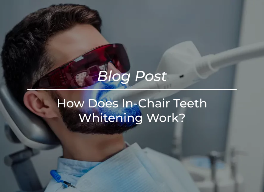 How Does In Chair Teeth Whitening Work