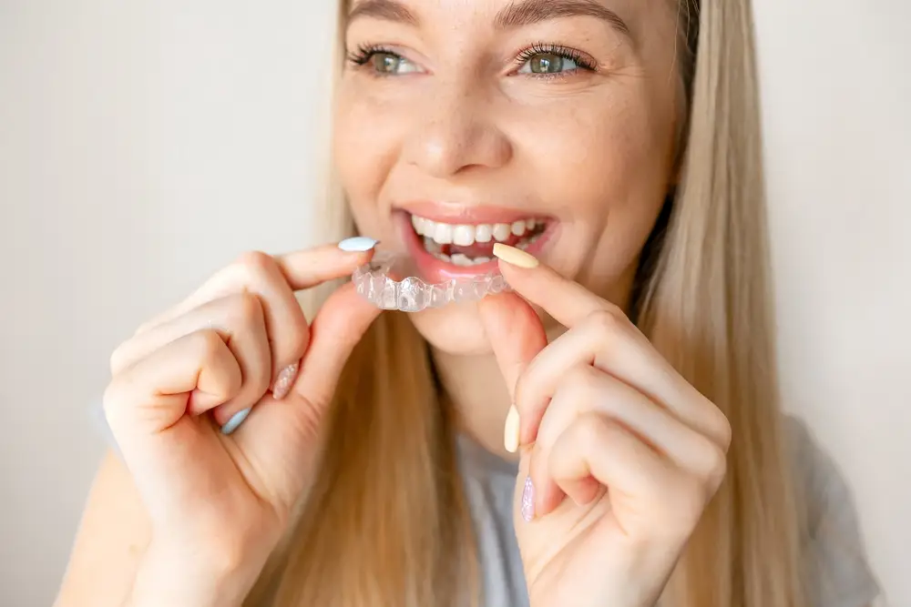 invisalign preston