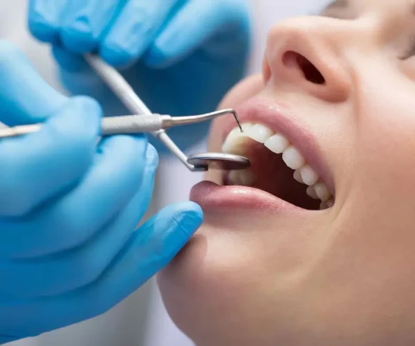 Affordable Tooth Extraction in Melbourne