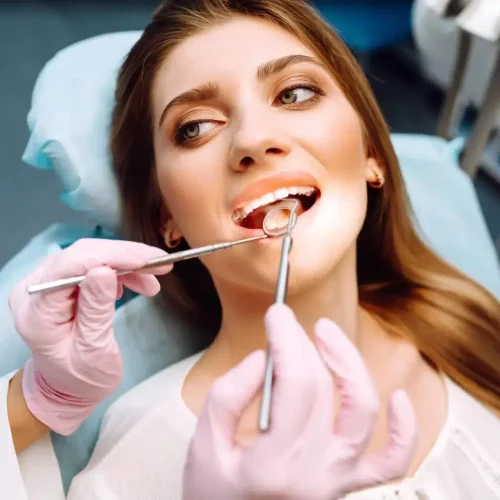 Composite Veneers Melbourne